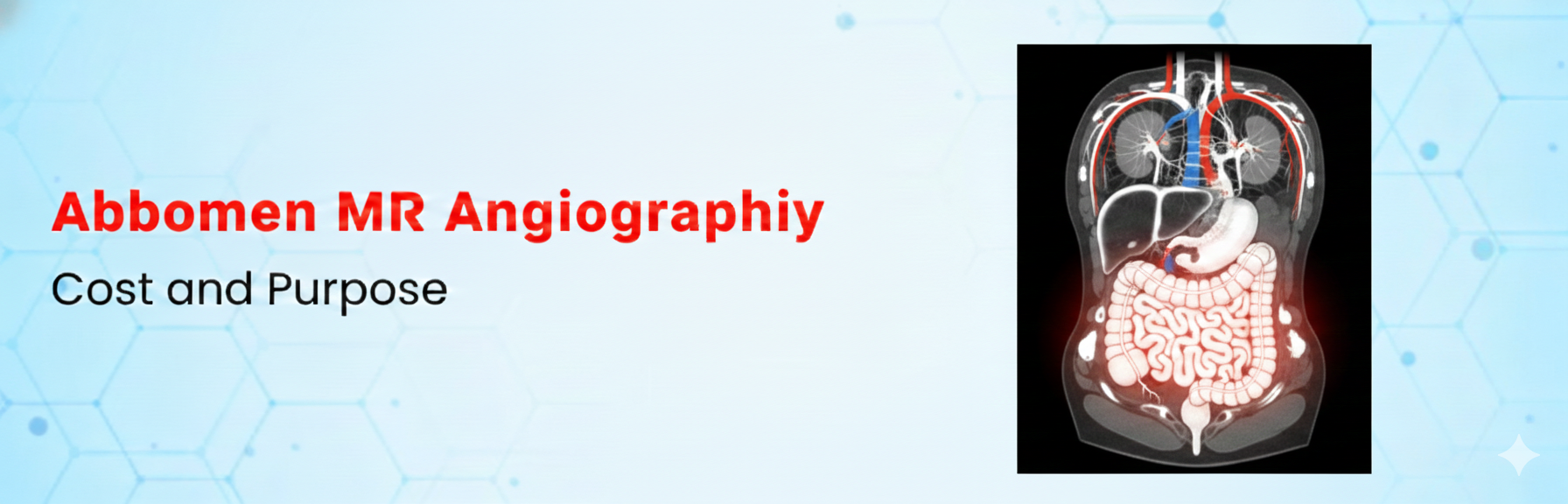  Abdomen MR Angiography: Cost and Purpose